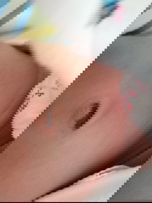 สะดือลูกเปฺ็นแบบนี้เช็ดออกดีมั้ยคะหรือมีวิธีทำความสะอาดมั้ยคะท้องแรกคะ