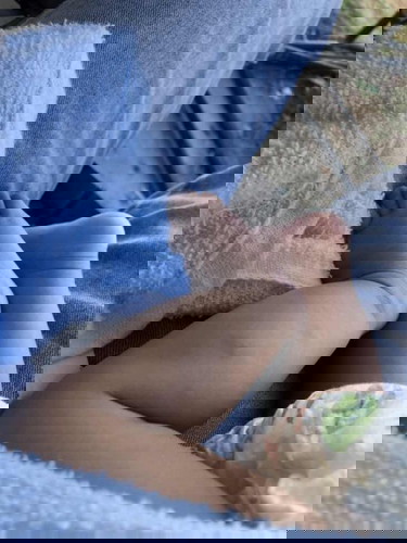 สงสัยลูกมีรอยแผลเกอดจากยุงกัด