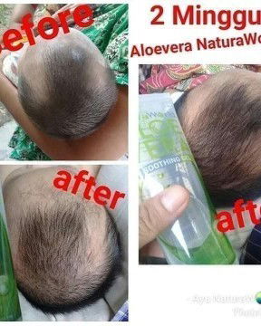 Natura ALOEVERA