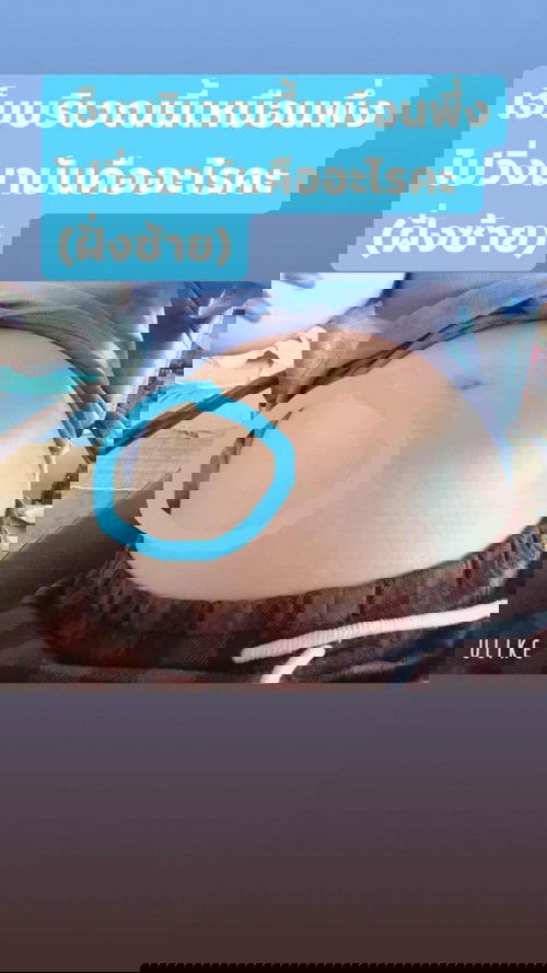 เจ็บแถวๆบริเวณนี้เจ็บเหมือนพึ่งไปวิ่งมามันคืออะไรคะ