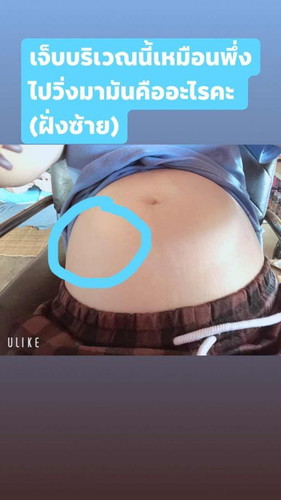 เจ็บแถวๆบริเวณนี้เจ็บเหมือนพึ่งไปวิ่งมามันคืออะไรคะ