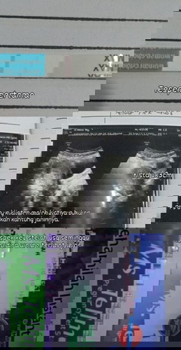 Flek kecoklatan emang selalu bikin khawatir