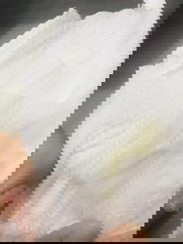 ตกขาวปนเลือด