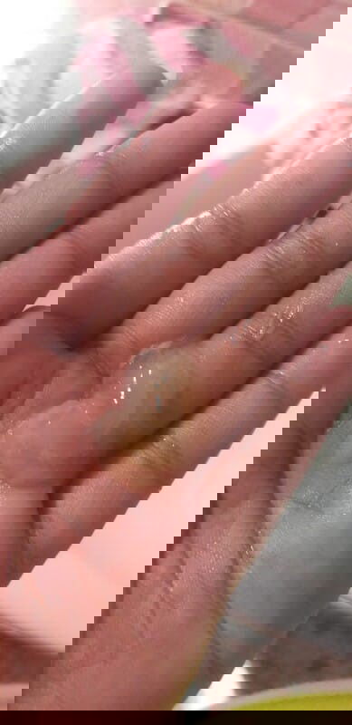 Mucus plug n po ba to?