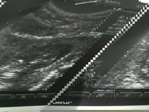 ขอคำปรึกษาหน่อยค่ะ