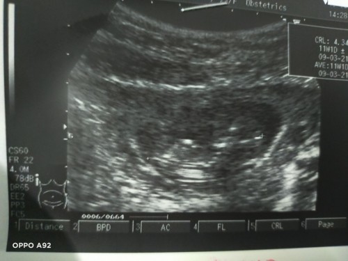 ขอคำปรึกษาหน่อยค่ะ