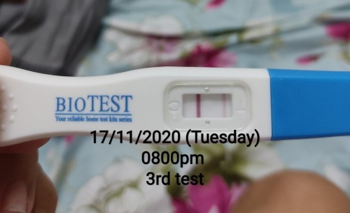 Sakit punggung & perut