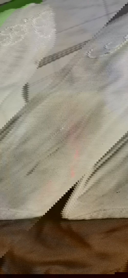 Spotting at 5 months