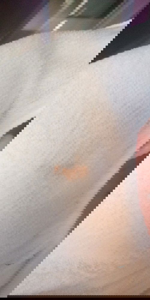 Pipis bayi umur 4 bulan ada bercak orangenya