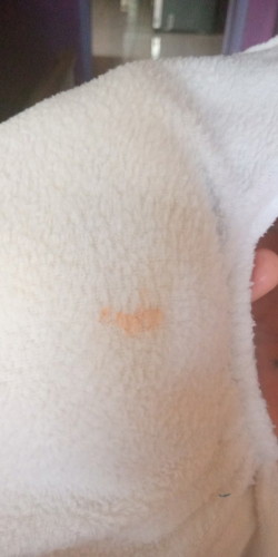 Pipis bayi umur 4 bulan ada bercak orangenya