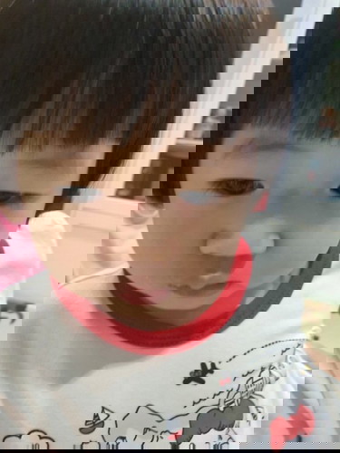 ค้นหา ยาทาแก้แพ้และลบรอยยุงกัด