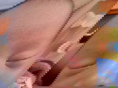 สอบถามหน่อยค่ะน้องมีผื่นแบบนี้และแห้งมากน้องจะเป็นอะไหมค้ะ แล้วใช้อะไรทาถึงจะหายค้ะ