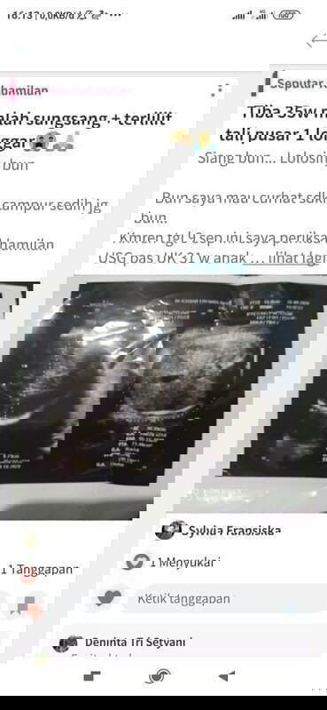 Lahir lewat HPL (HPL 5 nov 2020,lahir tgl 10 nov 2020) UK 40w6d launching😇💕