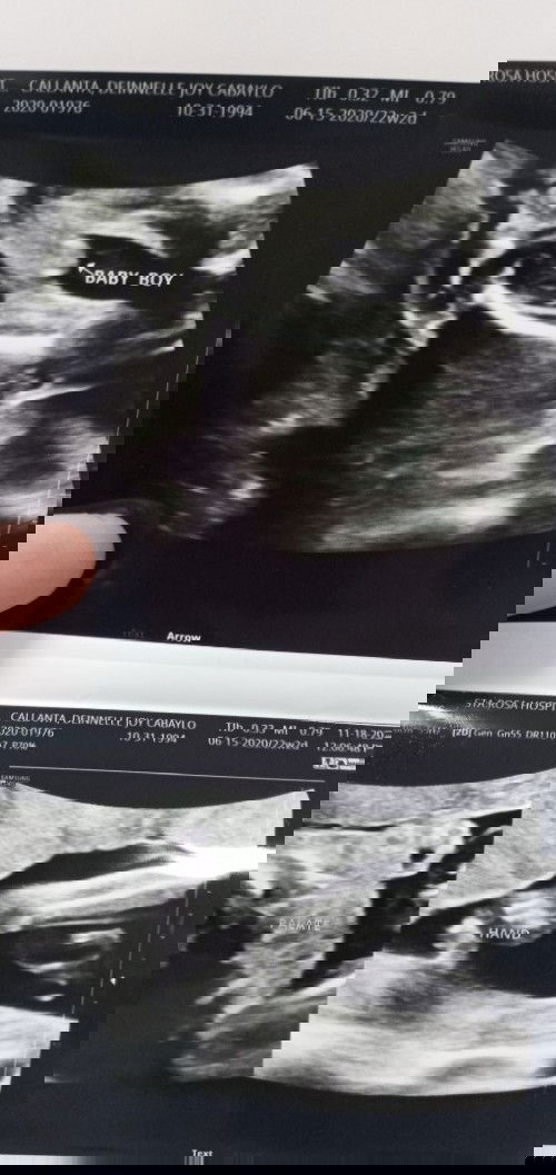 Answered prayer! Kaso my UTI and anemic pa din :(