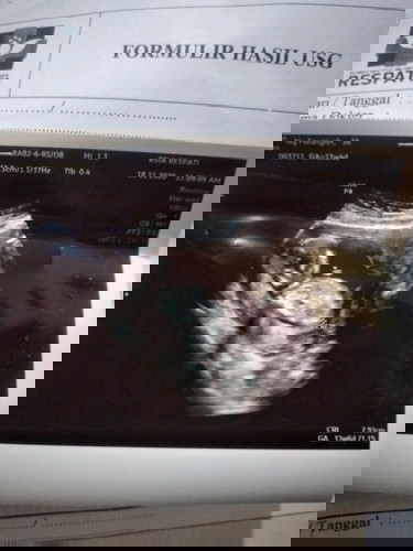 Alhamdulillah π€²π€²π€²