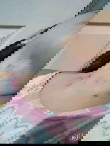 Ano po Kaya pwede I gamot dito?