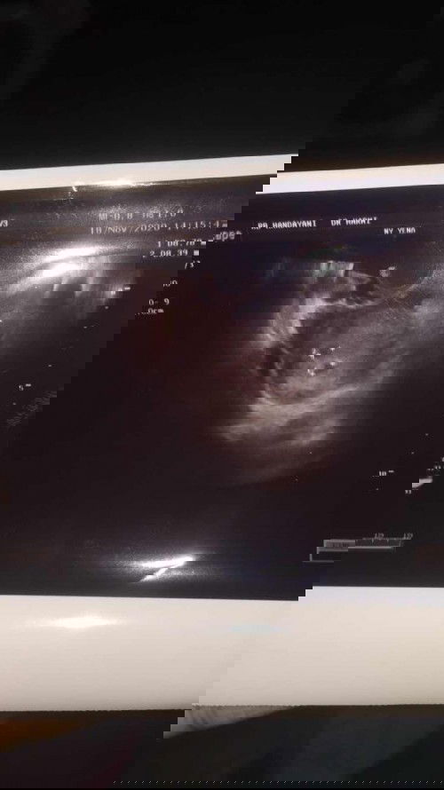 Ada g yg seperti aku dsni