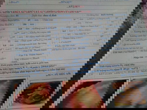 Xin ý kiến các mon