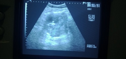 Ini saya usg yg ke 13 Minggu bun.tpi Sya blom bgtu jelas liat dd nya. ππ€