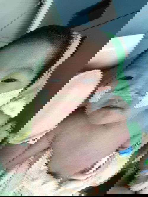 ประสบการณ์ลูกเป็น rsv #ฝากเตือนแม่ๆทุกคนนะค่ะ