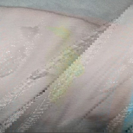 Mga momsh bakit ganito kulay ng vaginal discharge ko? ano po ba ibig sabihin nito?