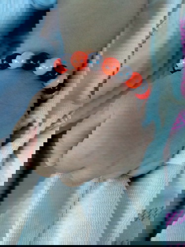 Hi momz.. baka may alam kau bakit naggaganito balat ng baby.. salamat.. ☺️