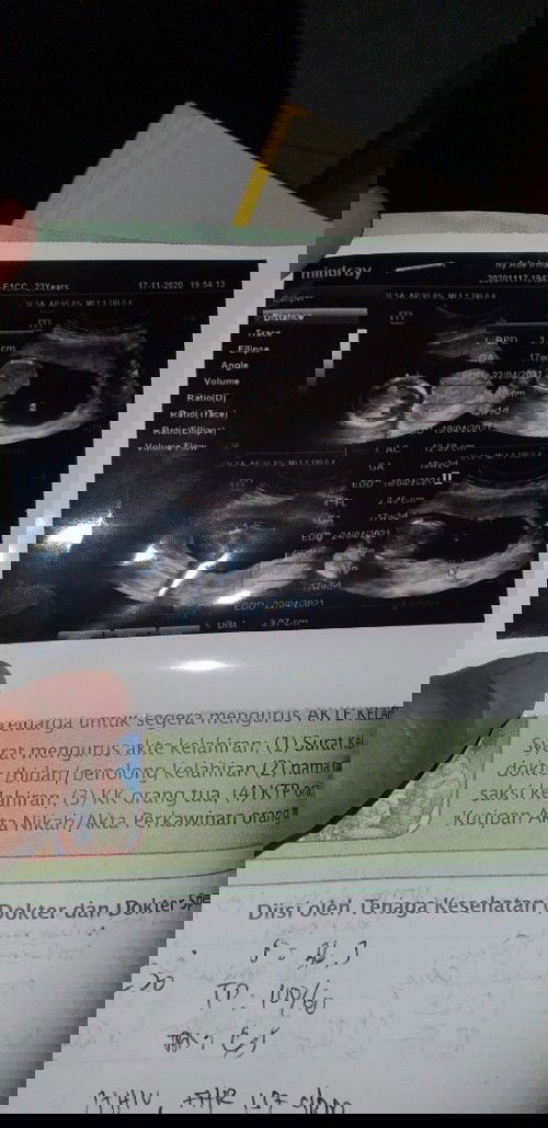 Hasil cek USG