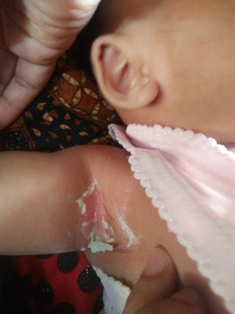 Obat untuk kulit sensitif