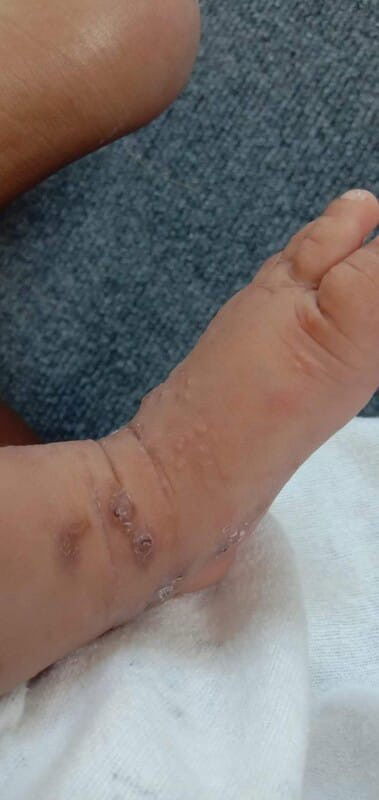 ขอคำแนะนำค่ะ