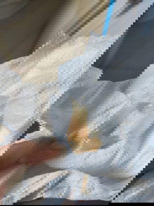 39+1ไม่มีอาการปวดท้องแต่มีเจบน่วงๆท้องแข็งบ่อย