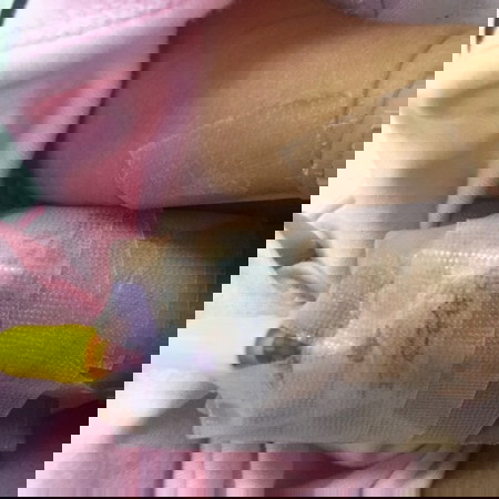 Sharing my baby's journey