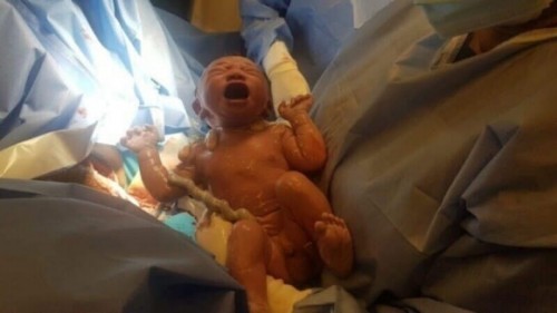 FINALLY HE'S OUT!!!😍 /5 hours labour