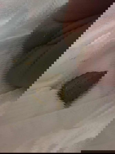 อึสีนี้ปกติมั้ยคะ ต้องพาไปหาหมอหรือป่าว?