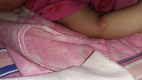 Ad yg pernah ga ky ank sya.