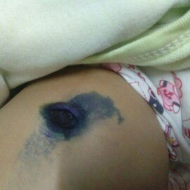 สอบถามเรื่องสะดือค่ะ