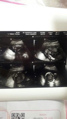 เพศชายจร้า