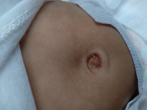 Basang pusod walang amoy