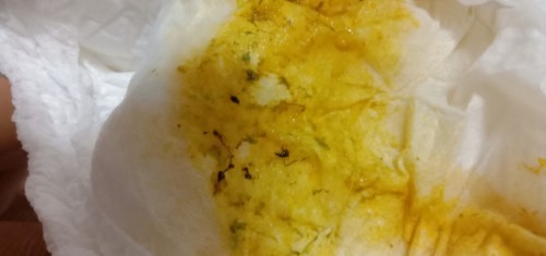 ลูอึมีสีดำๆปนออกมา