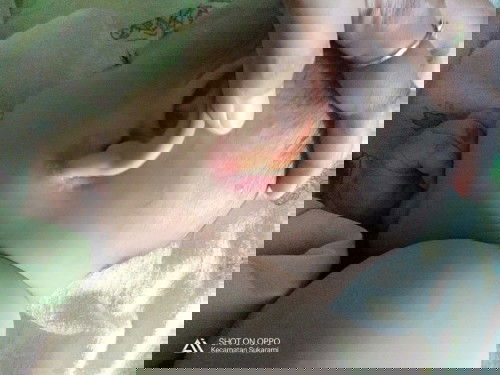 merah" ber air di telinga