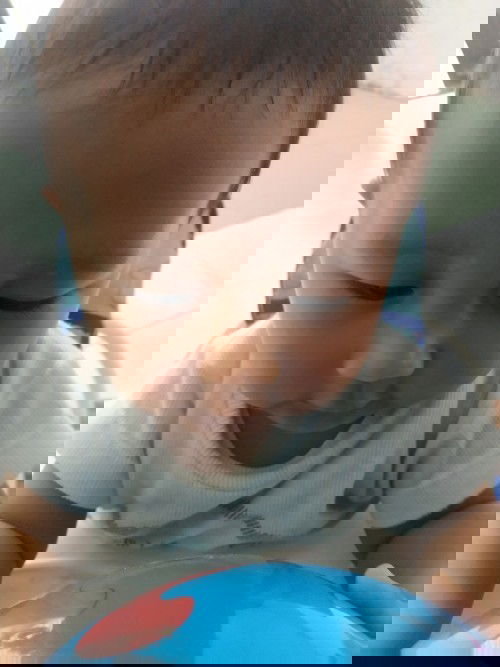 Putih putih pada wajah bayi