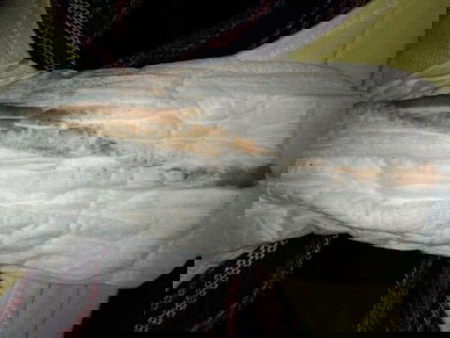 มีเลือดเป็นสีน้ำตาล