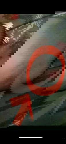 Benjolan di kepala baby