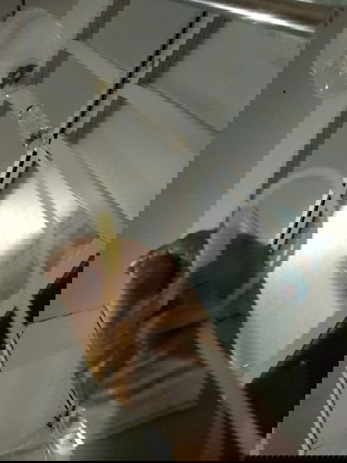 PLASENTA PREVIA TOTAL/MOHON DOANYA🙏