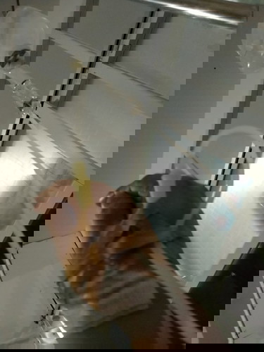 PLASENTA PREVIA TOTAL/MOHON DOANYA🙏