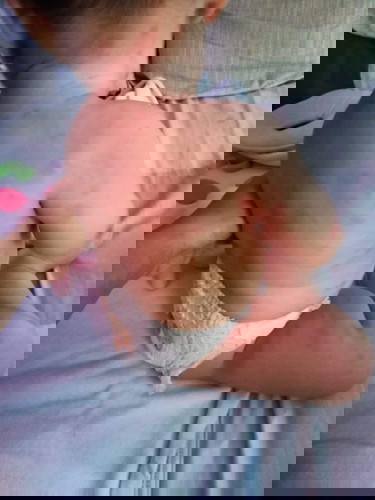 ผื่นขึ้น เกิดจากอะไร