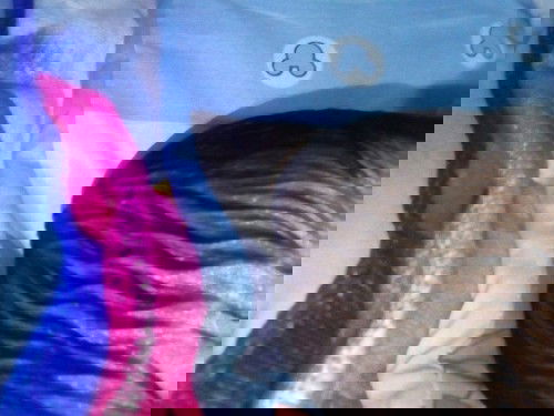 Mga mommy young baby kopo mula pagkapanganak may bukol na malambot sa leftside head nya ..malaki po