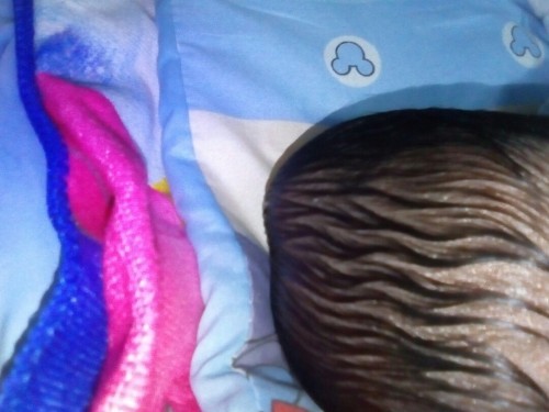 Mga mommy young baby kopo mula pagkapanganak may bukol na malambot sa leftside head nya ..malaki po