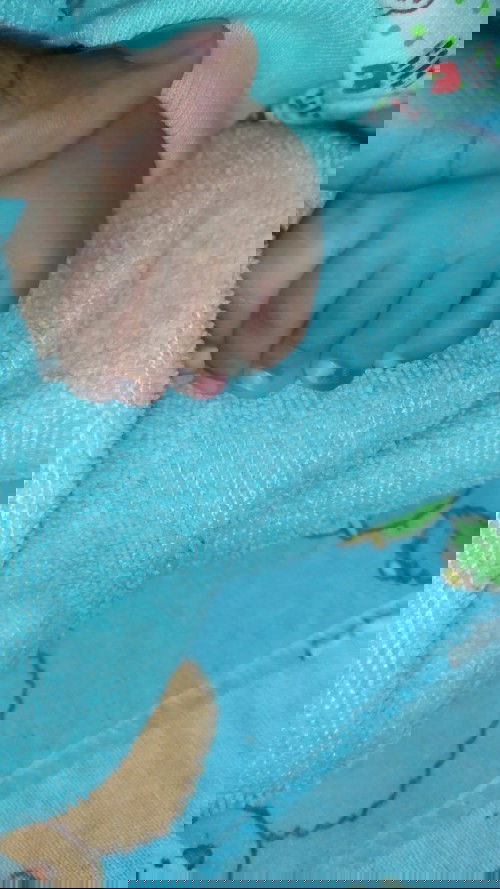 Warna merah pada kaki