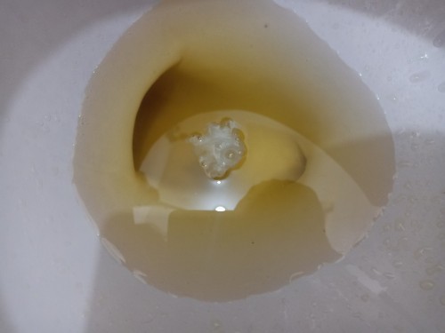 WHITE/YELLOW DISCHARGE