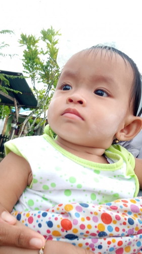 Bayi saya 10 bula lebih, semenjak sembuh dari campak dia gk suka makan ... Ada yg sama gk ya bun...